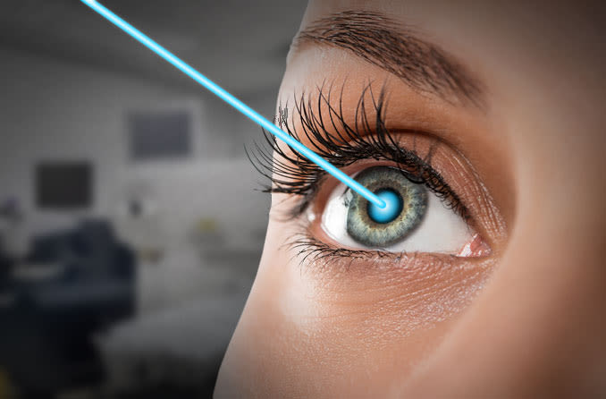 Is Laser Necessary For Cataract Surgery